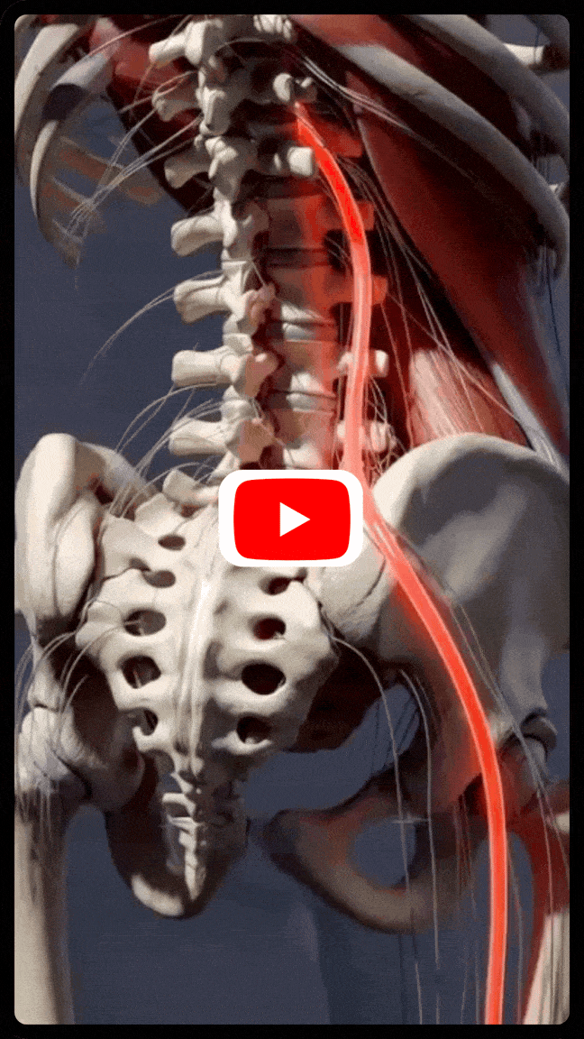 Sciatic nerve pain visual representation